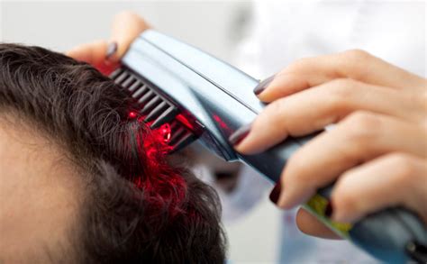 Laser Hair Loss Treatment in Malaysia (LLLT) - Toppik Malaysia