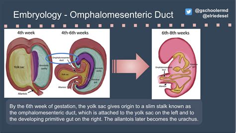 Omphalomesenteric Duct