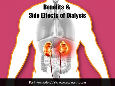 Benefits & Side Effects of Dialysis | Dialysis, Kidney dialysis, Chronic renal disease