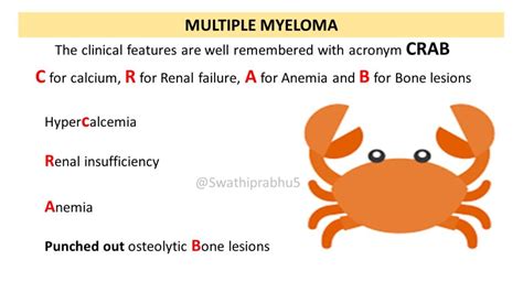 Pathology of Multiple Myeloma - Pathology Made Simple