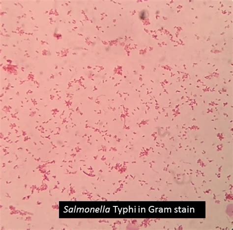 Salmonella Typhi : Gram stain, Colony Characteristics, Pathogenesis, Lab