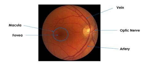 Moran CORE | How to Use the Direct Ophthalmoscope