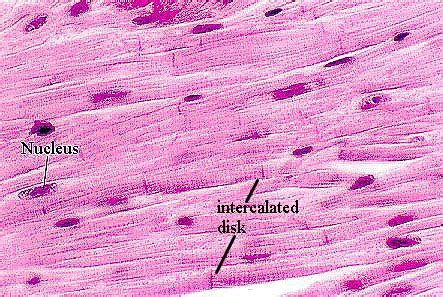 Skeletal Muscle Pathology I Flashcards Quizlet