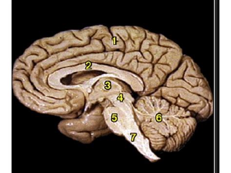 Cognitive Neuroscience Exam Flashcards Quizlet