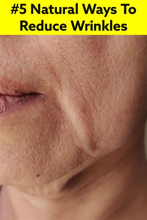 Five Natural Ways Can Help To Minimize The Appearance Of Wrinkles