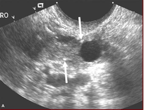 OB GYN 1 Midterm Pictures Ch 42 Pt 1 Flashcards Quizlet