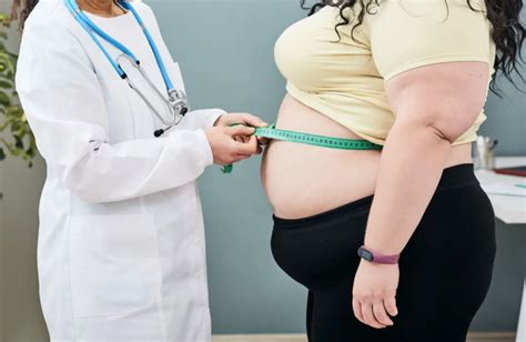 La Obesidad Del Mundo Se Concentra En Solo Pa Ses Estudio Salud En