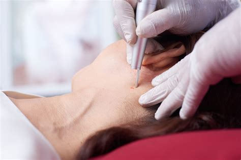 Everything You Need To Know About Permanent Hair Removal In Dubai