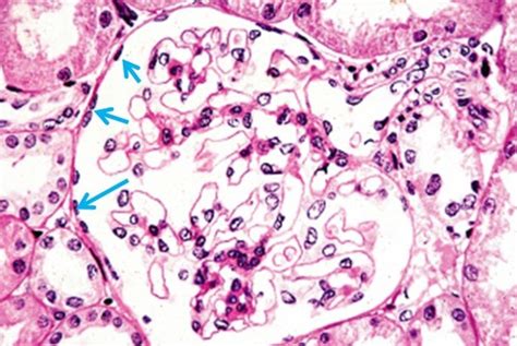 Tissue Histology Slides Fixed Flashcards Quizlet