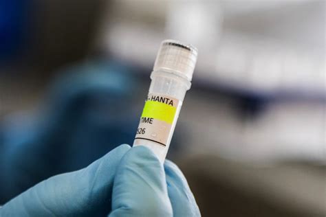 Tres hospitalizados en Europa tras brote de hantavirus en crucero | CR Hoy