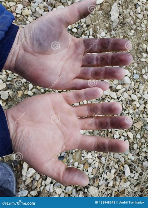 The Dirty Hands Of The Worker On The Construction Site Stock Photo