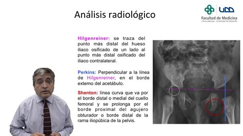 T Cnicas Radiol Gicas Video Clase Pelvis Pedi Trica Youtube