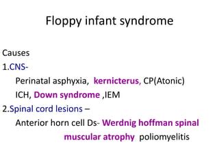 Floppy Infant Syndrome PPT