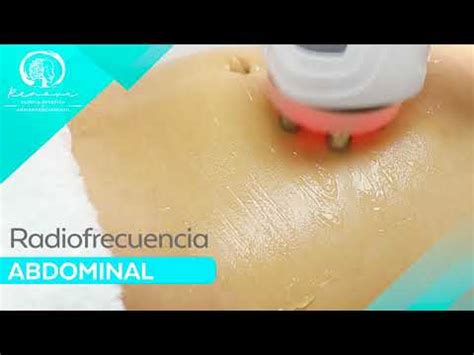 Radiofrecuencia abdominal Clínica Estética Renova YouTube