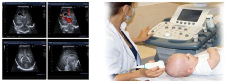 Neuroimaging-(Brain-Sonography)