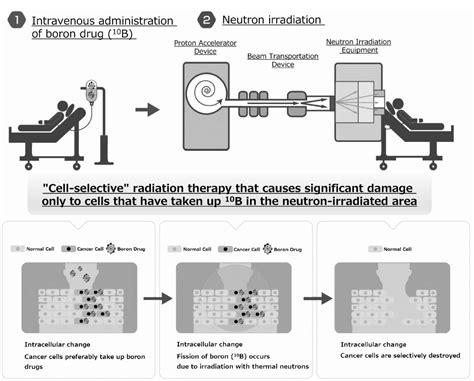 硼药硼中子bnct俘获治疗bnct硼中子俘获疗法boron Neutron Capture Therapy硼中子俘获治疗原理 无癌家园