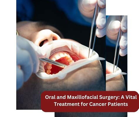 Oral and Maxillofacial Surgery: A Vital Treatment for Cancer