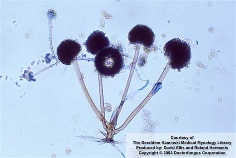 Rhizopus Phylum Zygomycota | Microbiology, Microbiology lab, Fungi