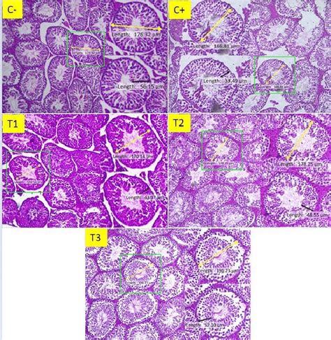 Seminiferous Tubules Histology