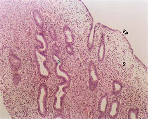 A Photomicrograph Of Human Endometrium Of Rpl Group Showing The Surface