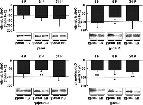 Time Course Of P Gp Protein Expression In The Jejunum Ileum Liver And Download Scientific