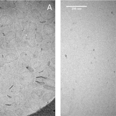 Cryo Transmission Electron Microscopy Tem Observation Of A Download Scientific Diagram