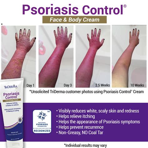 Psoriasis Control Face & Body Cream