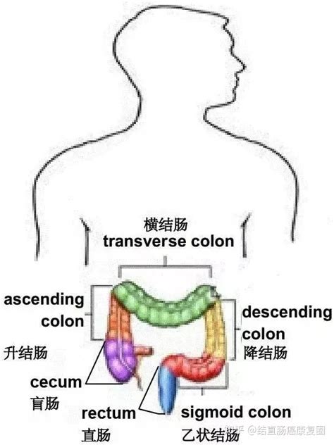 一文了解结直肠癌不同分期治疗方案 知乎