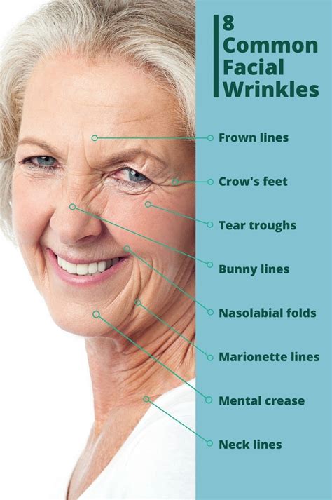 How To Get Rid Of Facial Wrinkles Identifying Problem Areas And Solutions