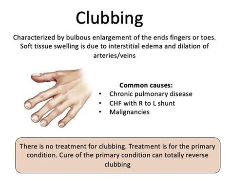 clubbing medizzy