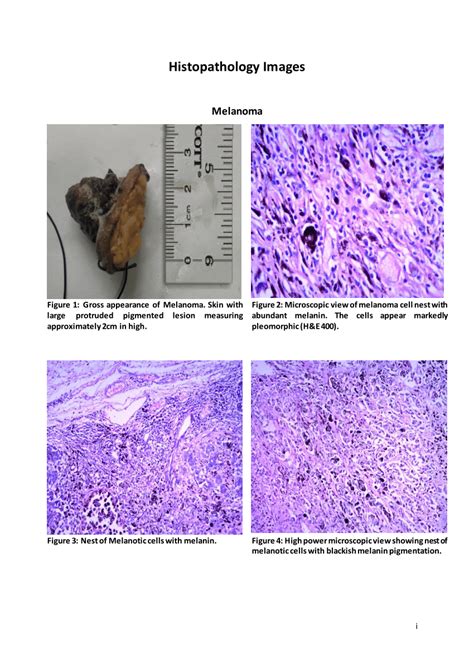 PDF Histopathology Images