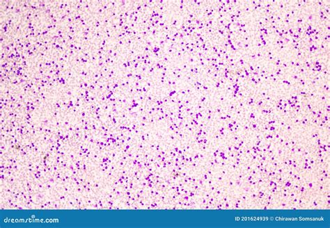 Cellule Modérée De Souffle Des Globules Blancs Dans La Calomnie De Sang