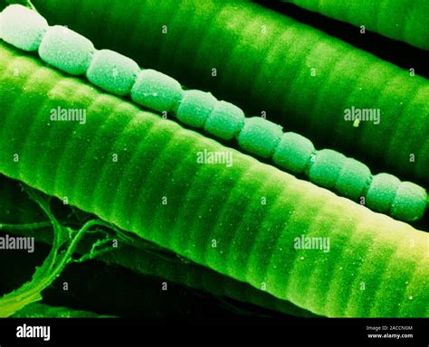 False Colour Scanning Electron Micrograph Sem Of Two Species Of Blue