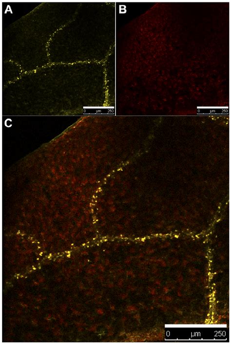 Subcellular Localization Of Ste1 Yfp Protein In Arabidopsis