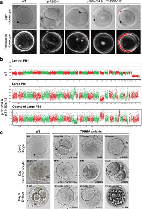 Morphology Of Oocytes Zygotes And Embryos From Control Individuals Download Scientific