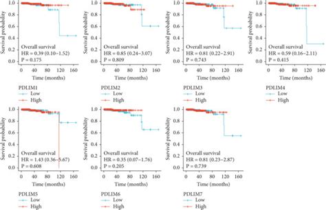 High Pdlim2 Expression Was An Independent Predictor Of Poor Prognosis