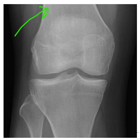 Anat Anatomic Correlations In Radiology Of Le Flashcards Quizlet