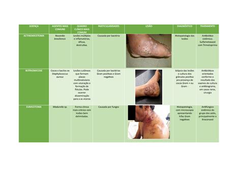 Anota Es Aula Micoses Subcut Neas Doen A Agentes Mais Comuns Quadro