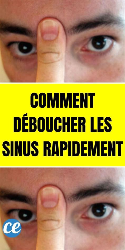 Comment D Boucher Vos Sinus En Secondes Avec Votre Langue Et Votre