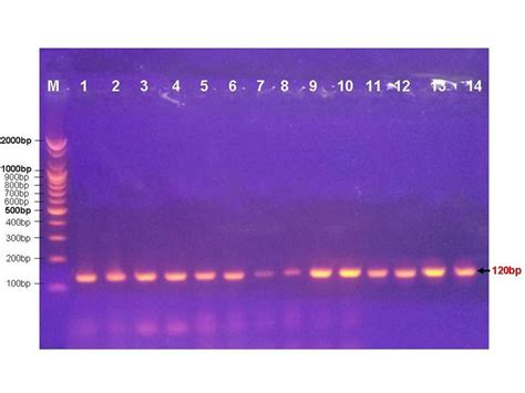 Agarose Gel Electrophoresis Of Pcr Amplified Srrna Gene Showing