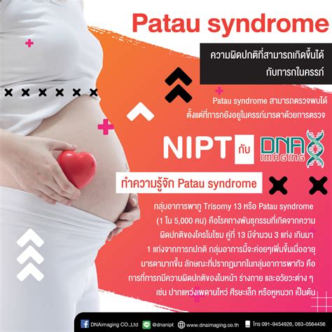 Patau syndrome... - DNAimaging Co.,Ltd | Facebook