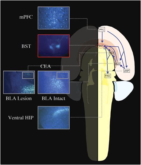 Compensation In The Neural Circuitry Of Fear Conditioning Awakens Learning Circuits In The Bed