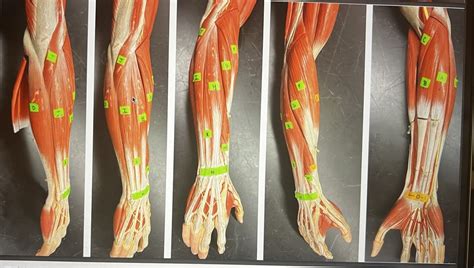 muscles- lower arm Diagram | Quizlet