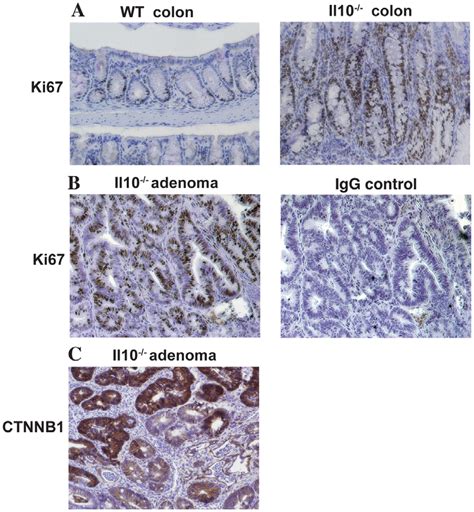 Il10 2 2 Normal Colon And Adenomas Exhibit Increased Cell Download Scientific Diagram