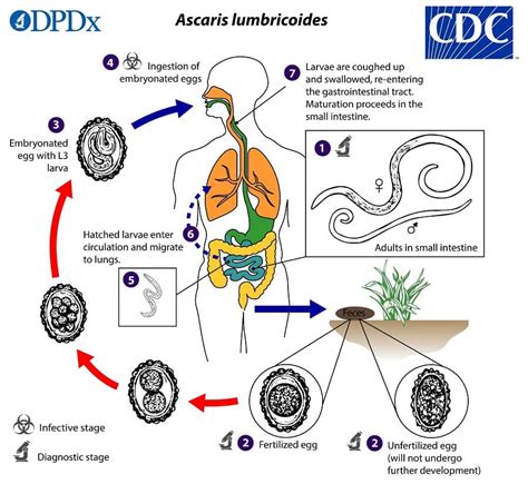 Ascaris Lumbricoides Life Cycle Pathogenicity Clinical Manifestation