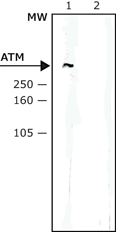 Anti Atm Antibody Mouse Monoclonal Clone Syr D Purified From