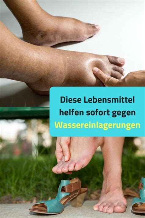 Geschwollene F E Geschwollene Beine Lebensmittel Helfen Beim