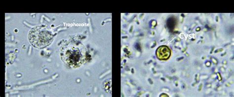 Direct Examination Of Entamoeba Spp Trophozoite And Cyst A Download Scientific Diagram