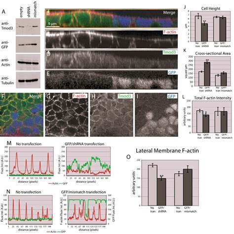 Tmod Knockdown By Shrna Results In Altered Cell Morphology And