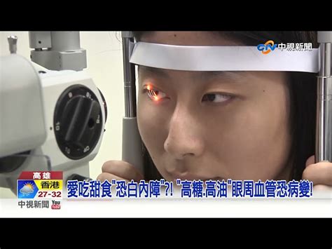 愛吃甜食竟傷眼恐白內障 躺滑手機最慘失明│中視新聞 20221001